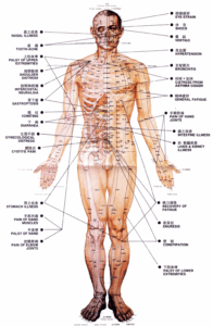 acupuncture